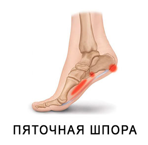 П'яткова Шпора
